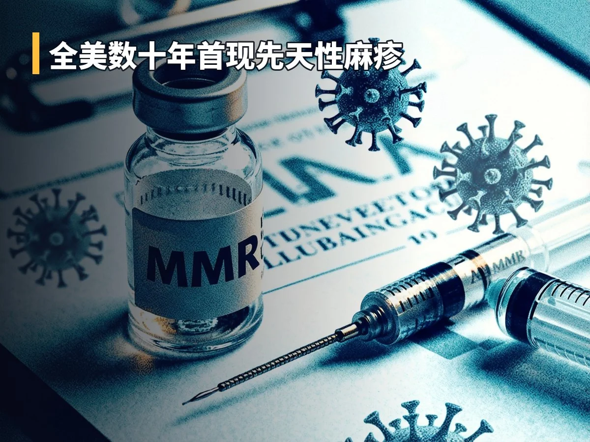 全美数十年首现先天性麻疹