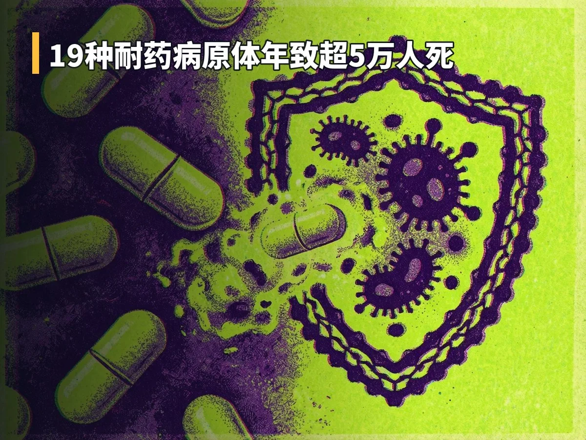 19种耐药病原体年致超5万人死