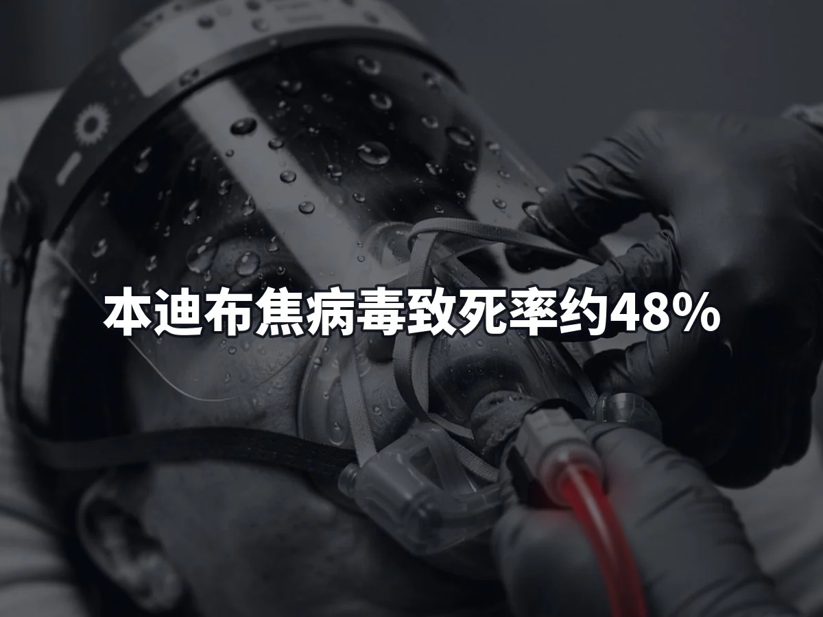本迪布焦病毒致死率约48%